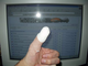 a72360-Hole in thumb.jpg